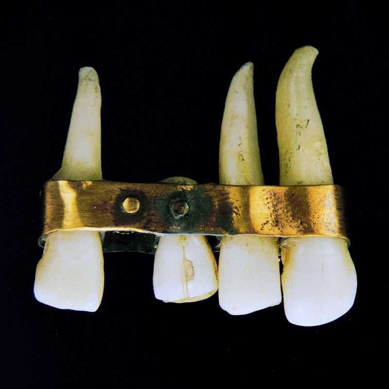 Самые необычные зубные протезы в истории