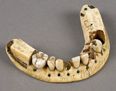 Самые необычные зубные протезы в истории